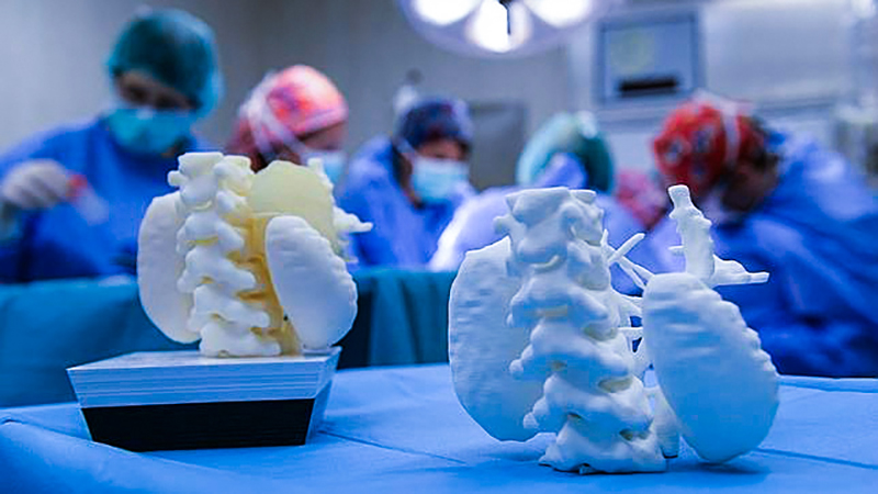 3dtumor.jpg